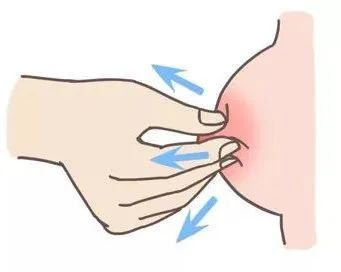 大乳头、小乳头、扁平乳头、凹陷乳头3大喂养指导及护理指南！