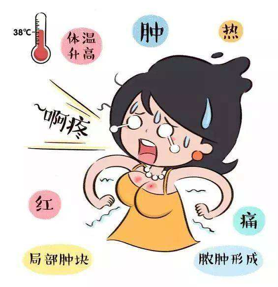 乳房生理性肿胀
