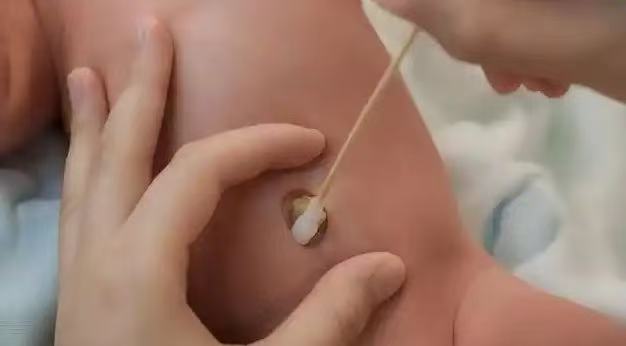  肚脐眼里的污垢，到底能不能抠？ 