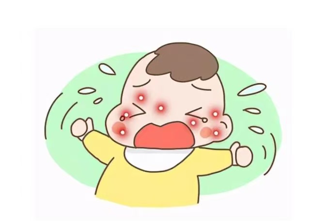 孩子湿疹反复发作怎么办？这些防治方法请收好！